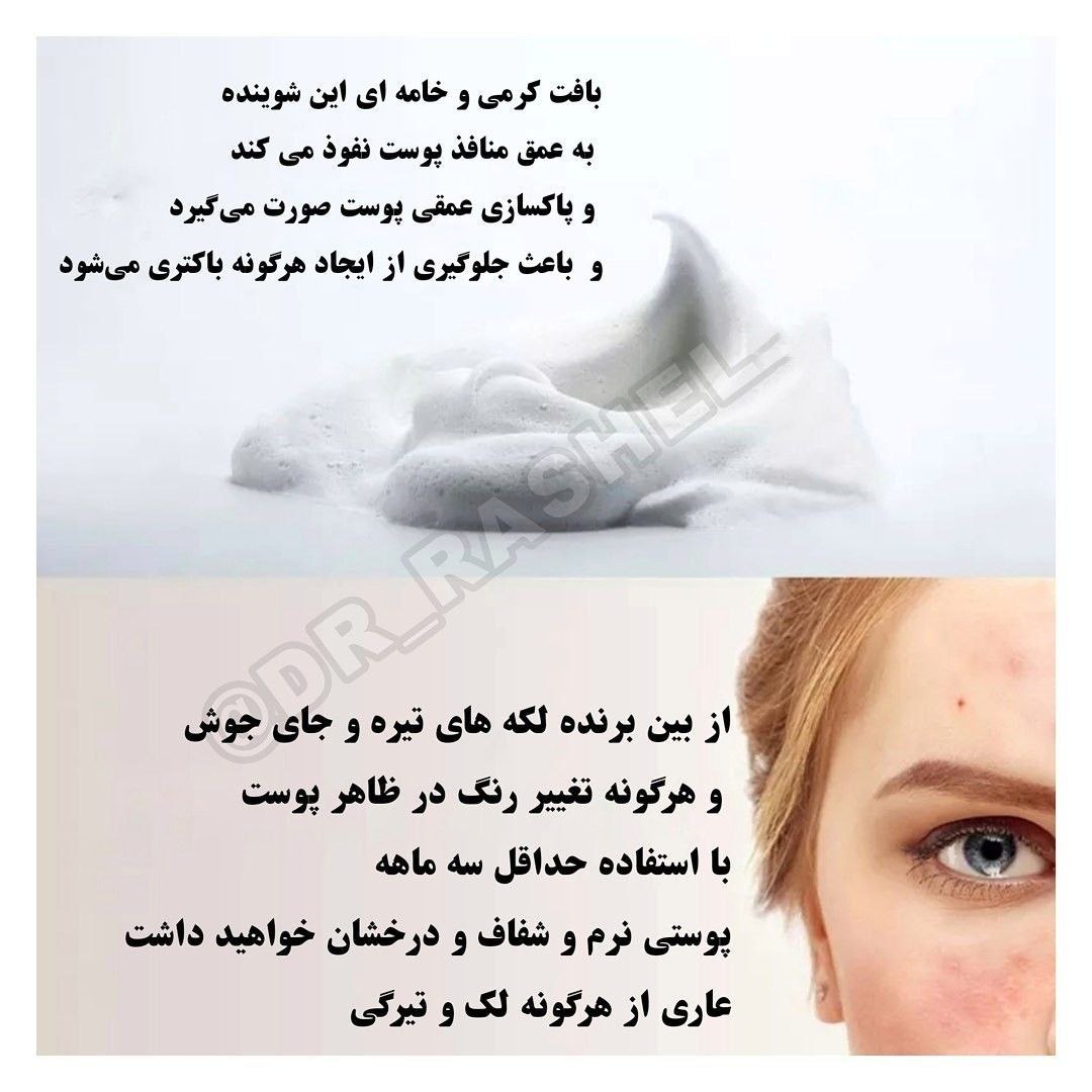 شوینده صورت نیاسینامید